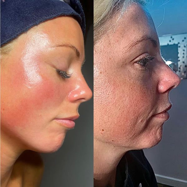 Image courtesy of Grafton Spa & Wellness and NeoGen