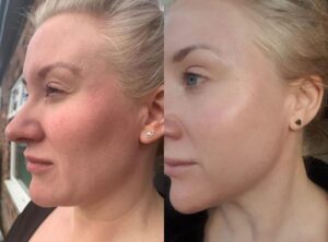 Image courtesy of The Skin Sanctuary, Doncaster