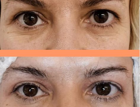 NeoGen_Eye_preview_7